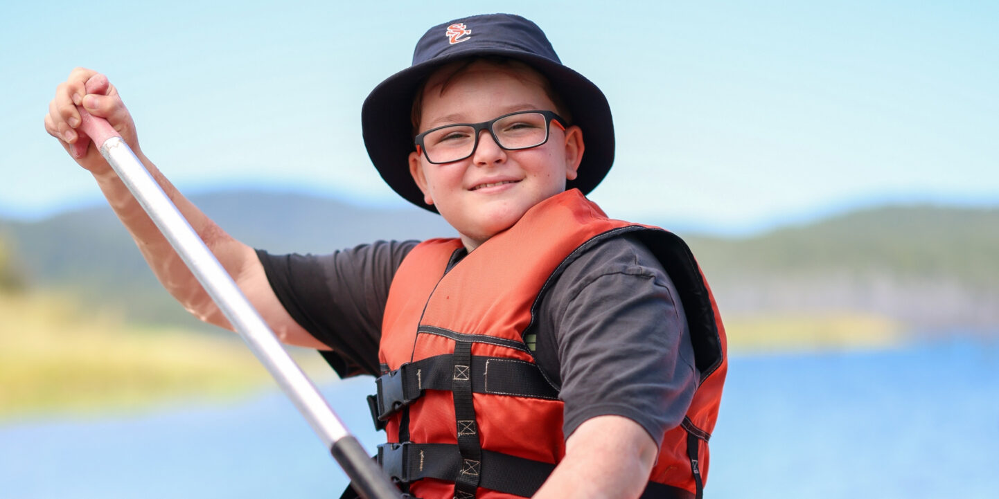 Charlie, 11, burns